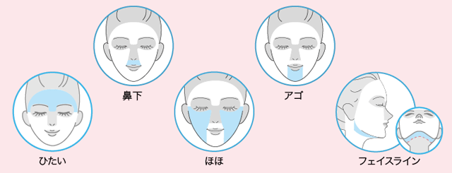 顔脱毛に含まれる部位