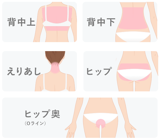 全身脱毛応援コース